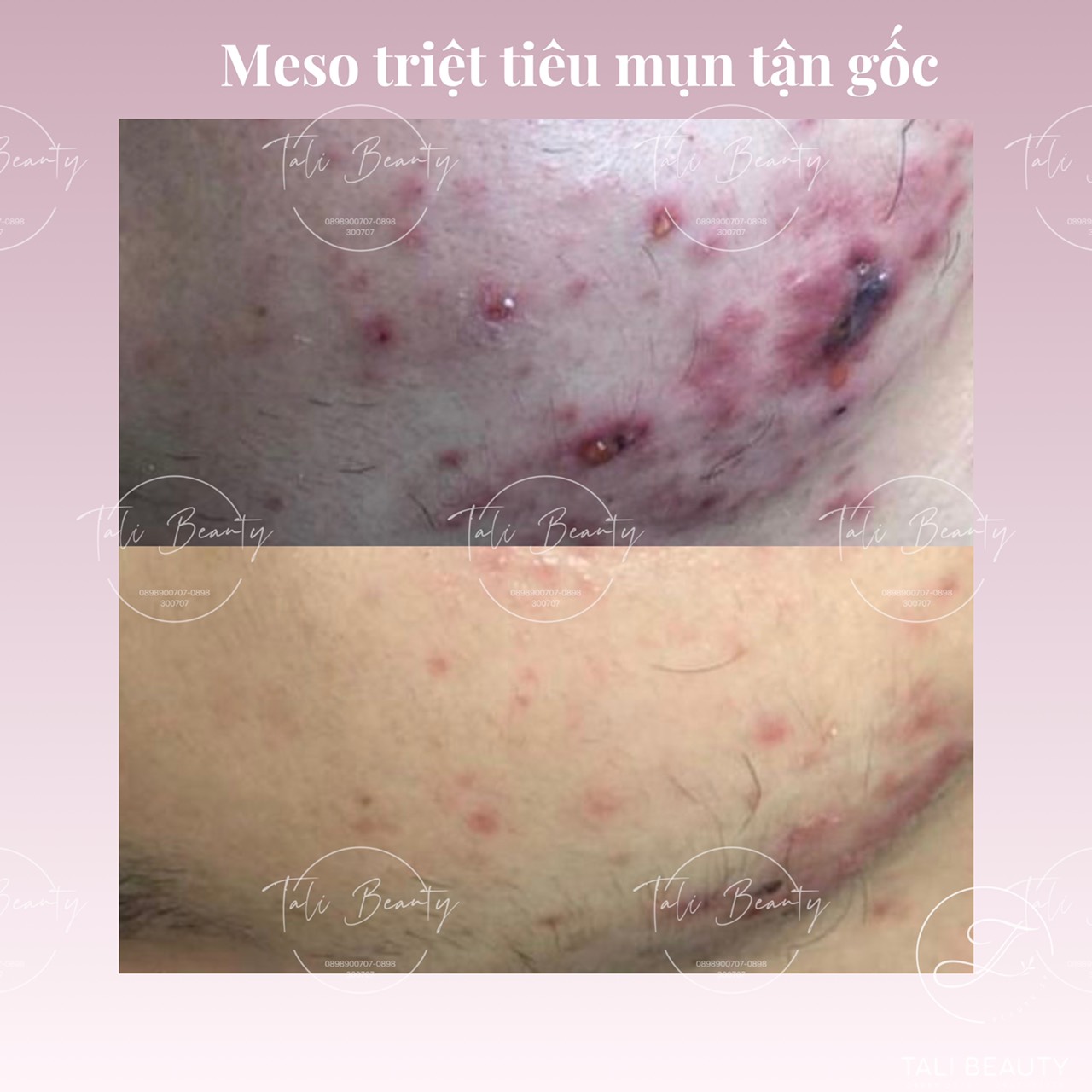 Xem Ảnh Lớn