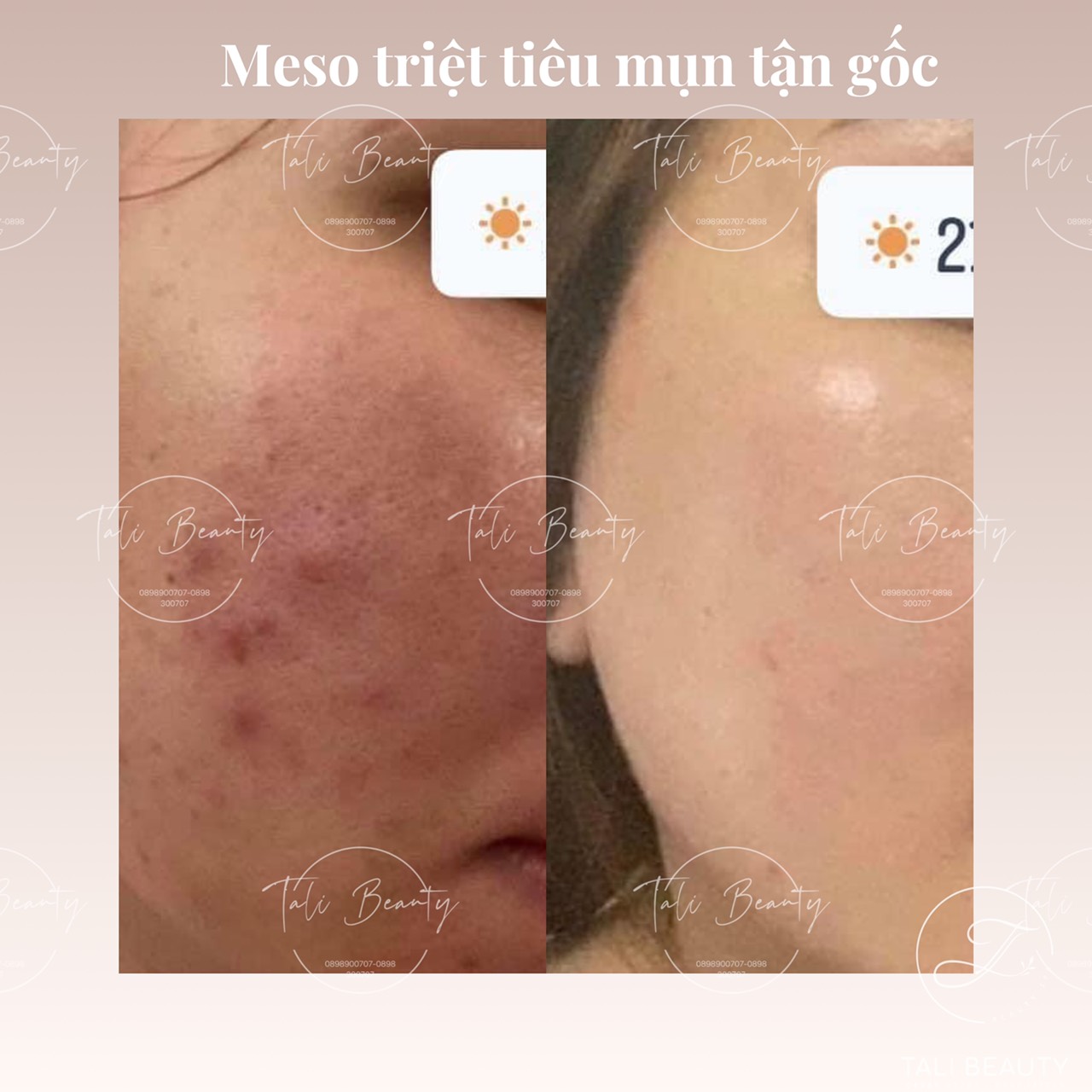 Xem Ảnh Lớn