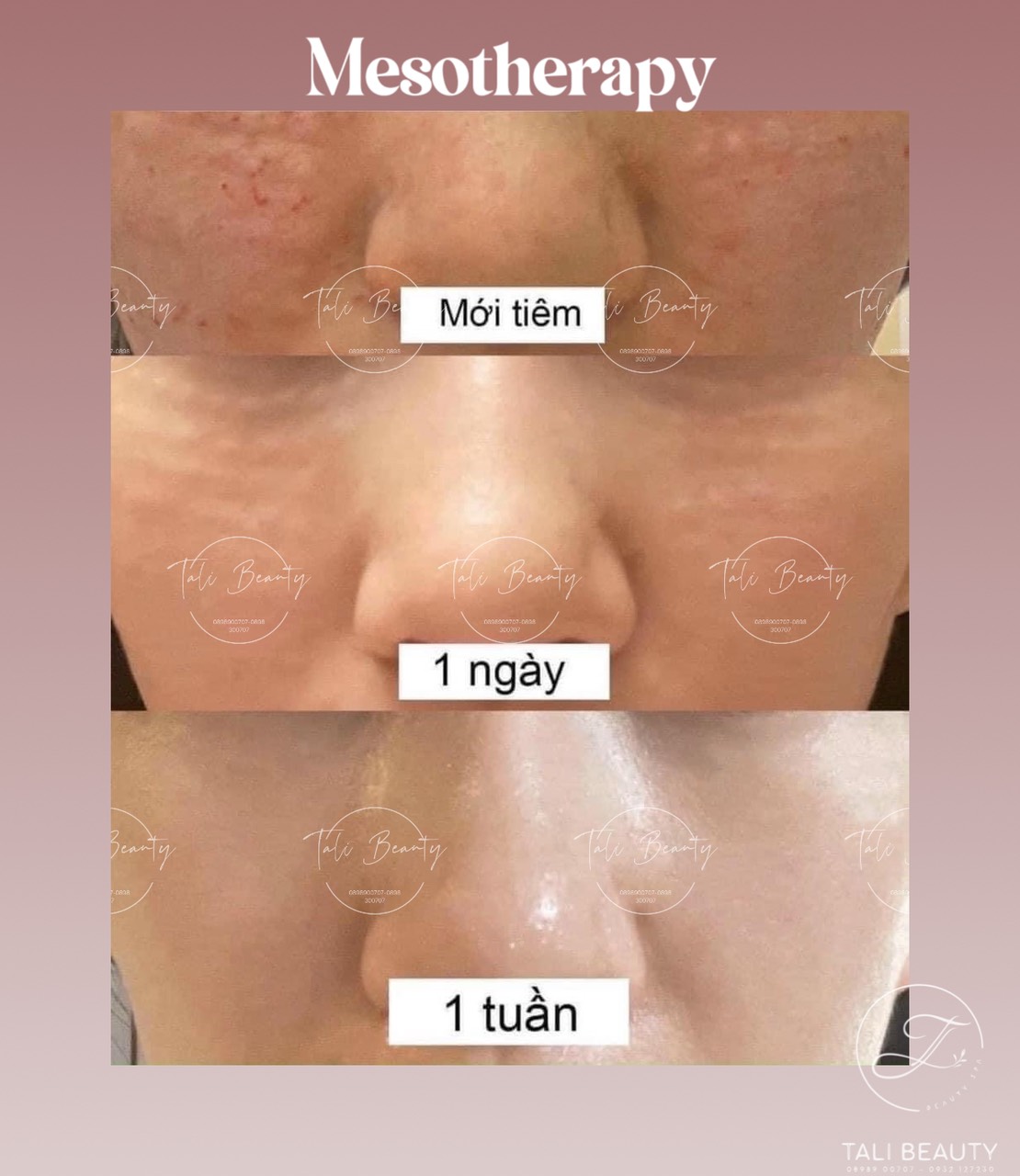 Xem Ảnh Lớn
