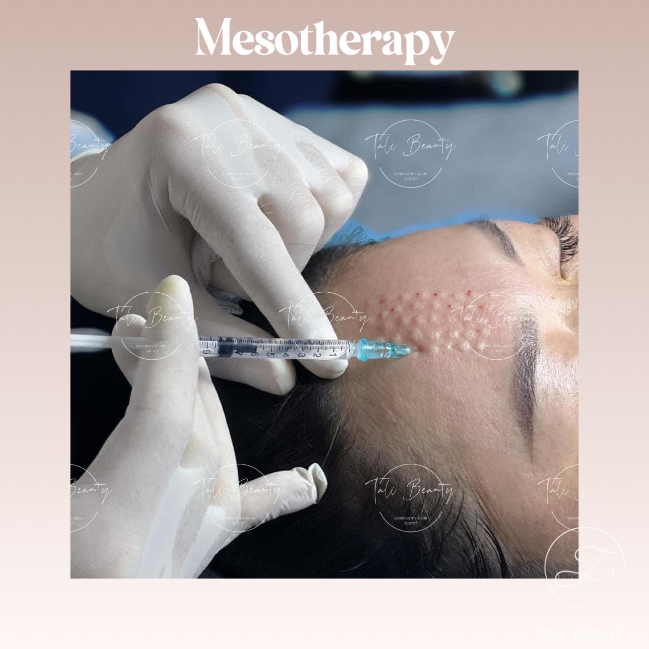 Xem Ảnh Lớn