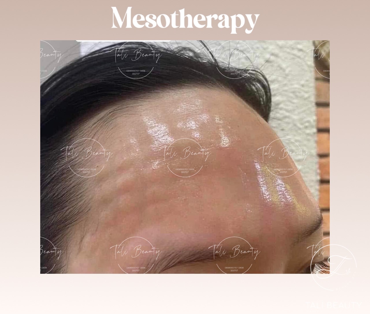 Xem Ảnh Lớn