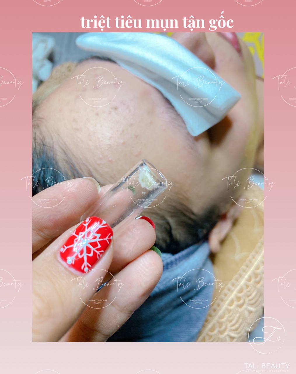 Xem Ảnh Lớn
