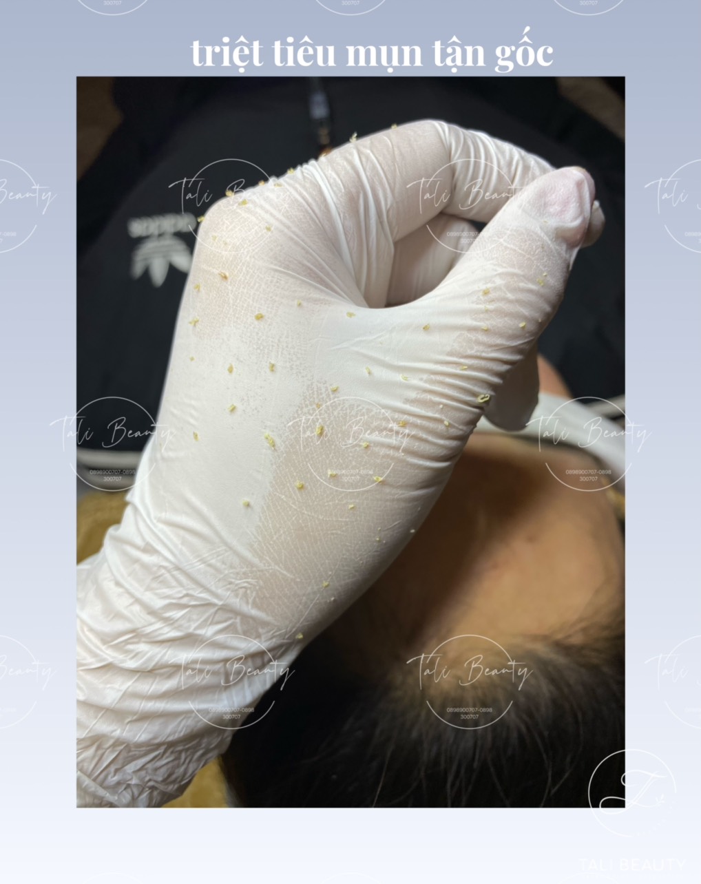 Xem Ảnh Lớn