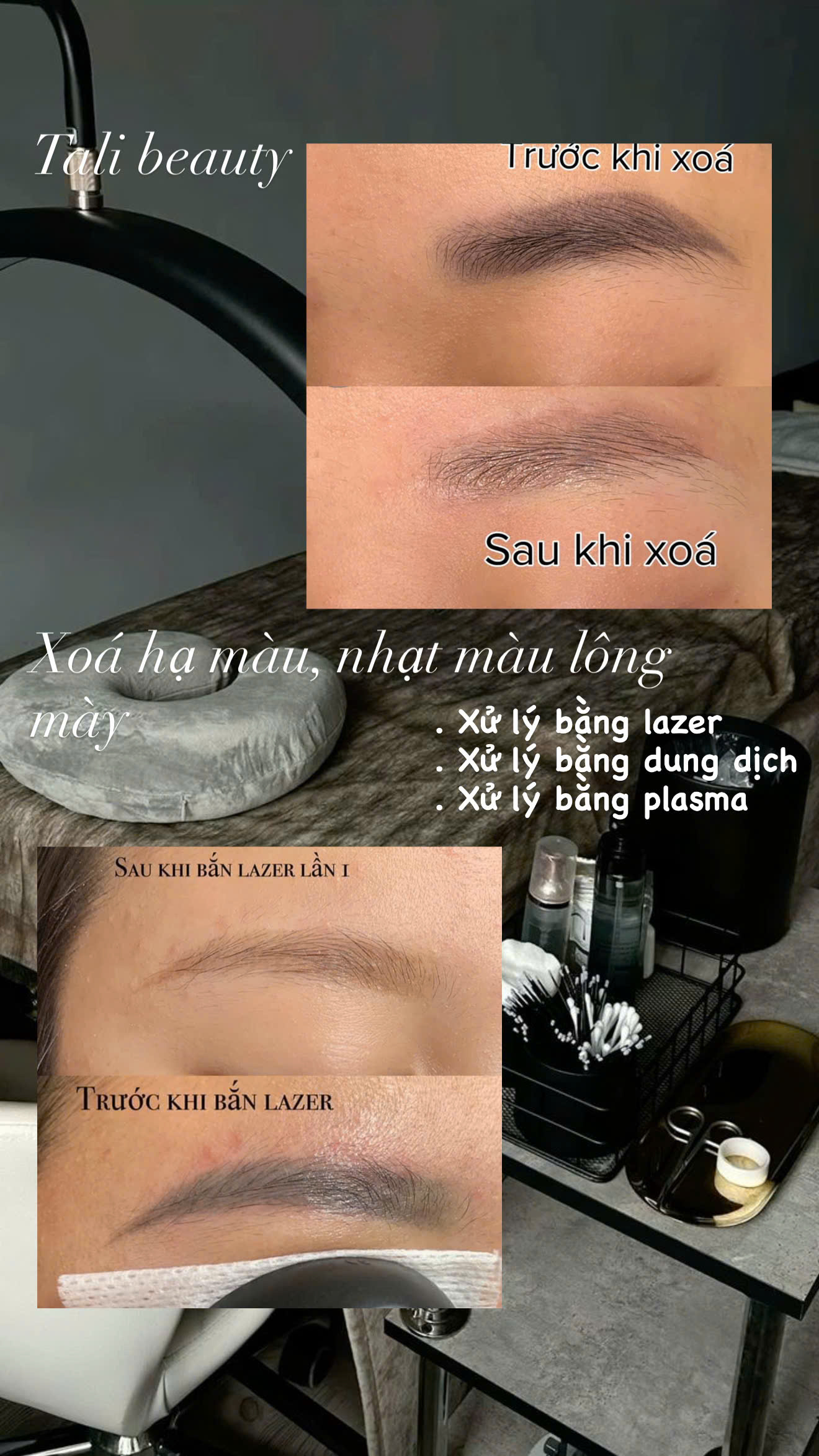 XÓA LÔNG MÀY ĐA PHƯƠNG PHÁP