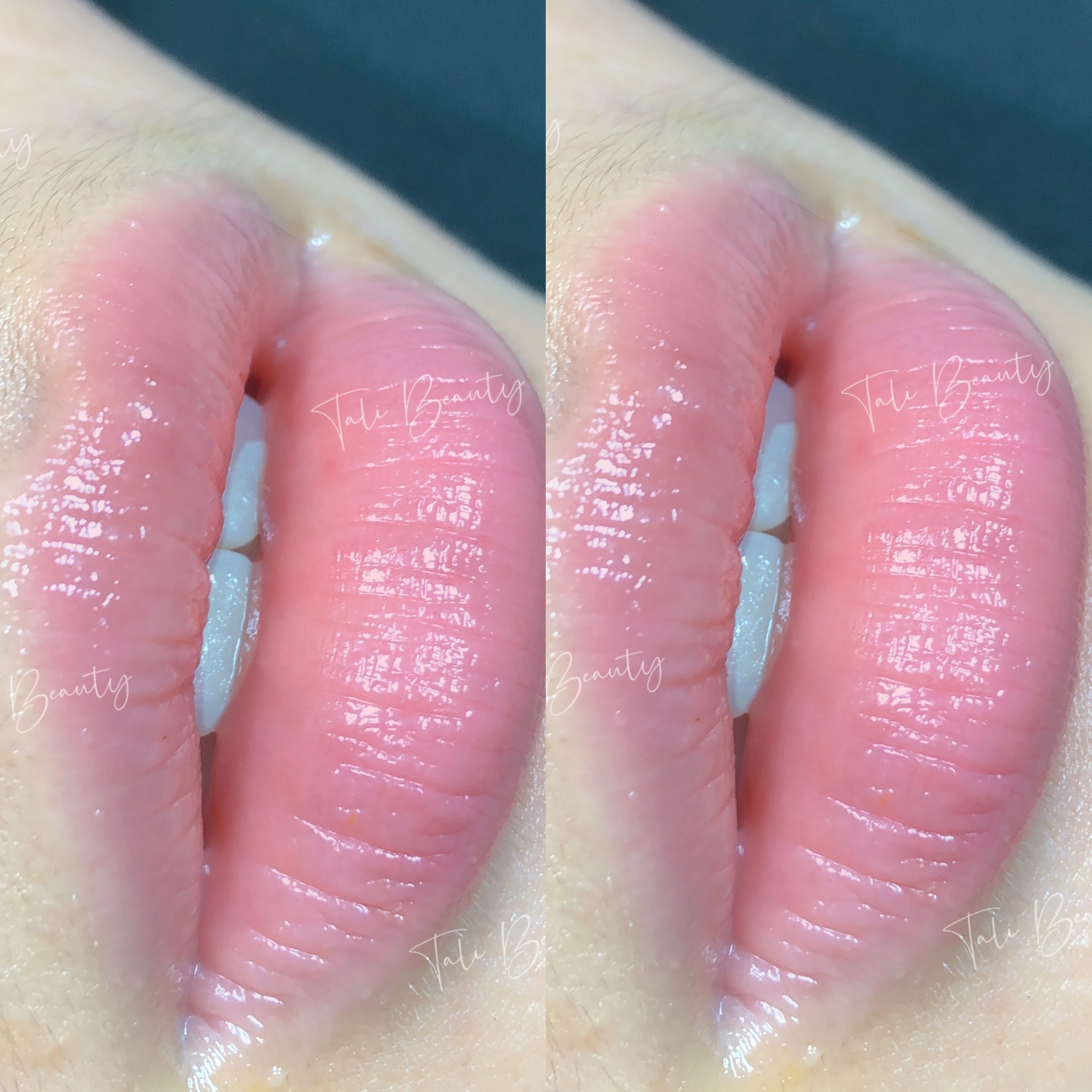 Xem Ảnh Lớn