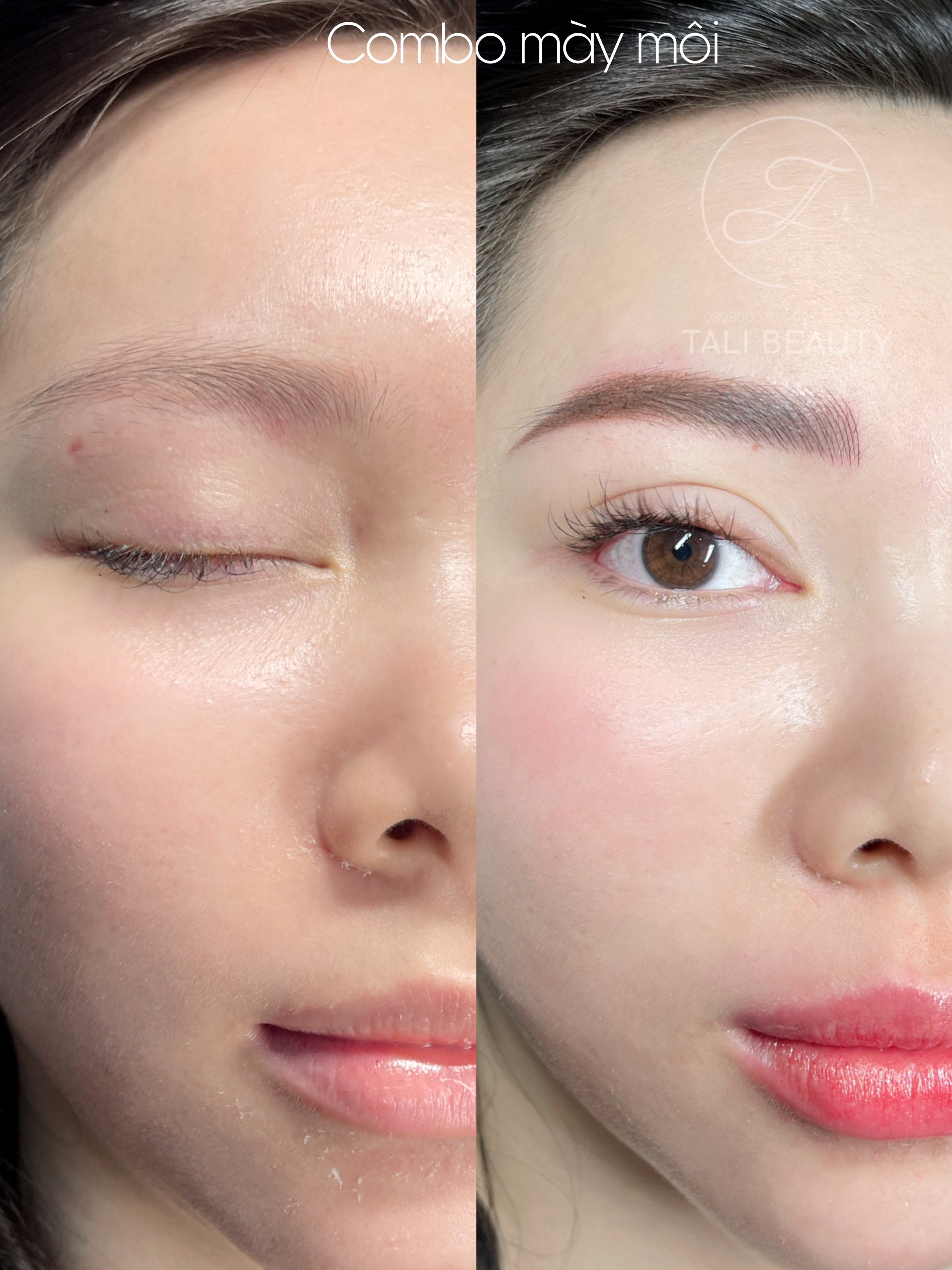 Xem Ảnh Lớn