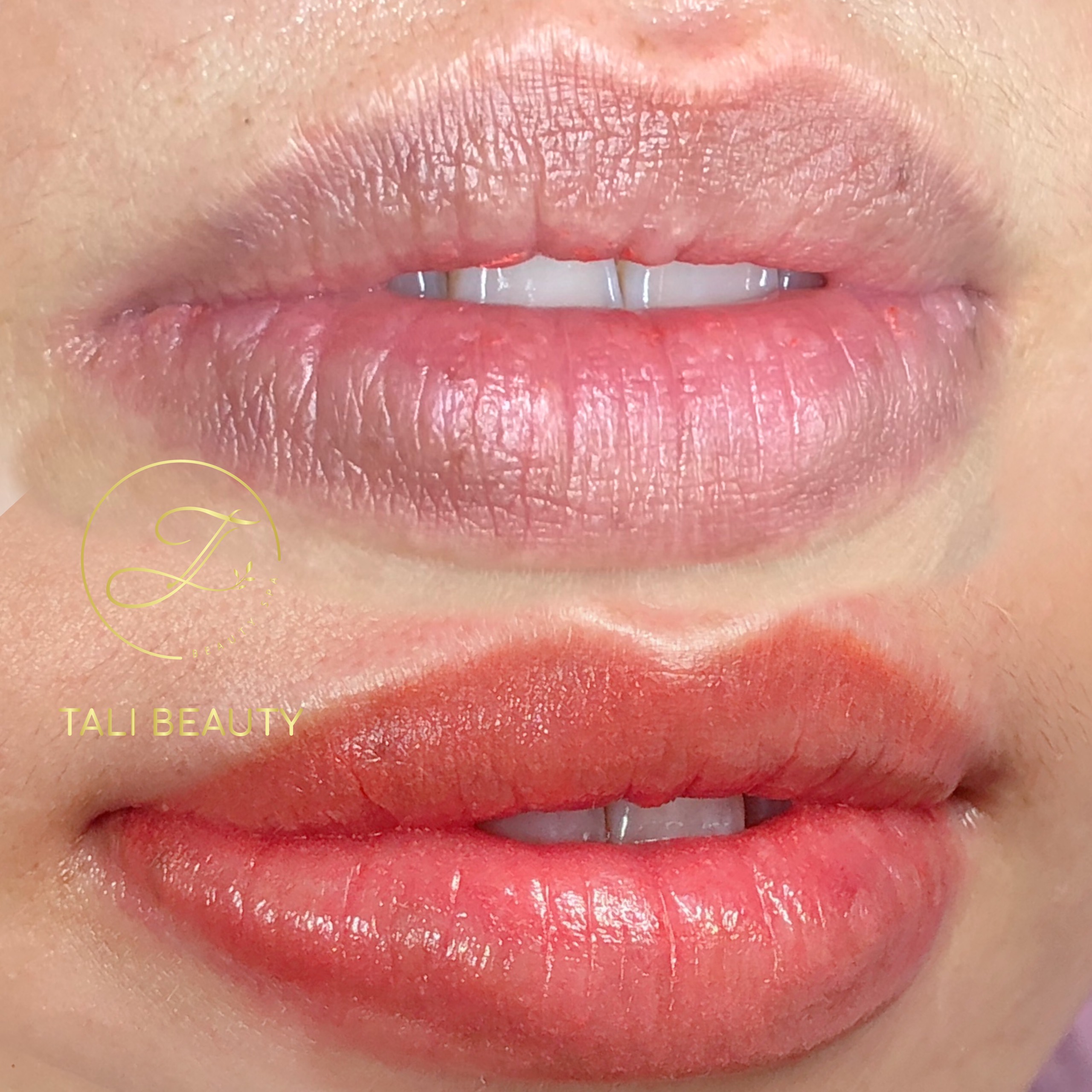Phun Môi Candy Lip L-Lips Tali Beauty – Làn Môi Tươi Tắn, Tự Nhiên Quyến Rũ