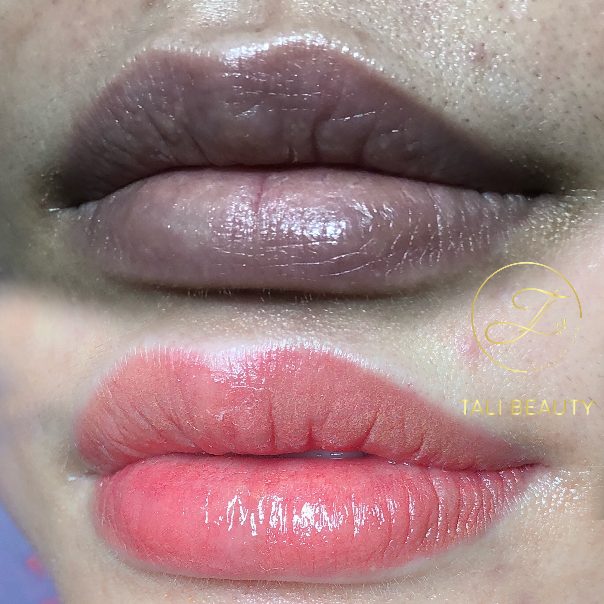 Phun Môi Candy Lip L-Lips Tali Beauty – Làn Môi Tươi Tắn, Tự Nhiên Quyến Rũ