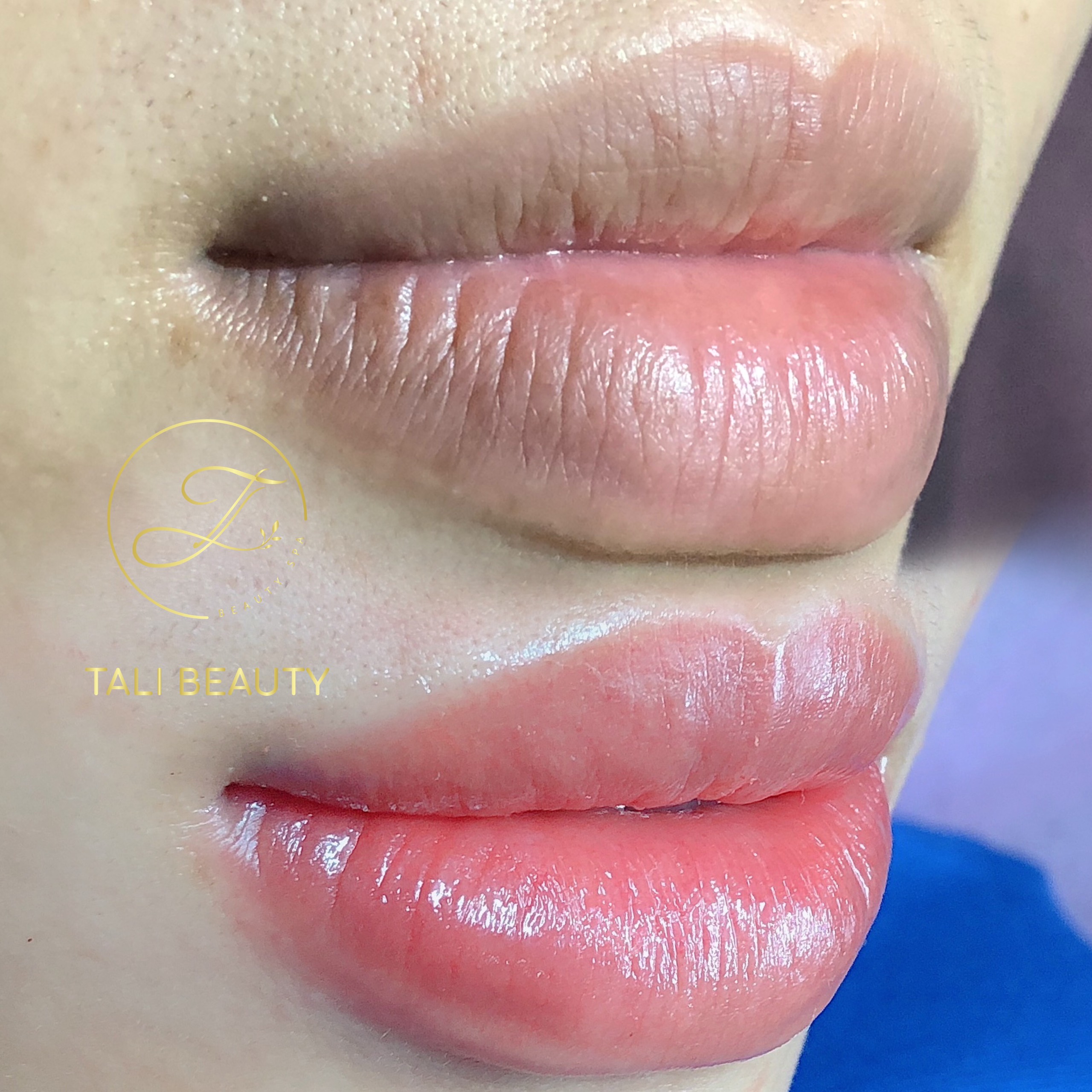 Phun Môi Candy Lip L-Lips Tali Beauty – Làn Môi Tươi Tắn, Tự Nhiên Quyến Rũ