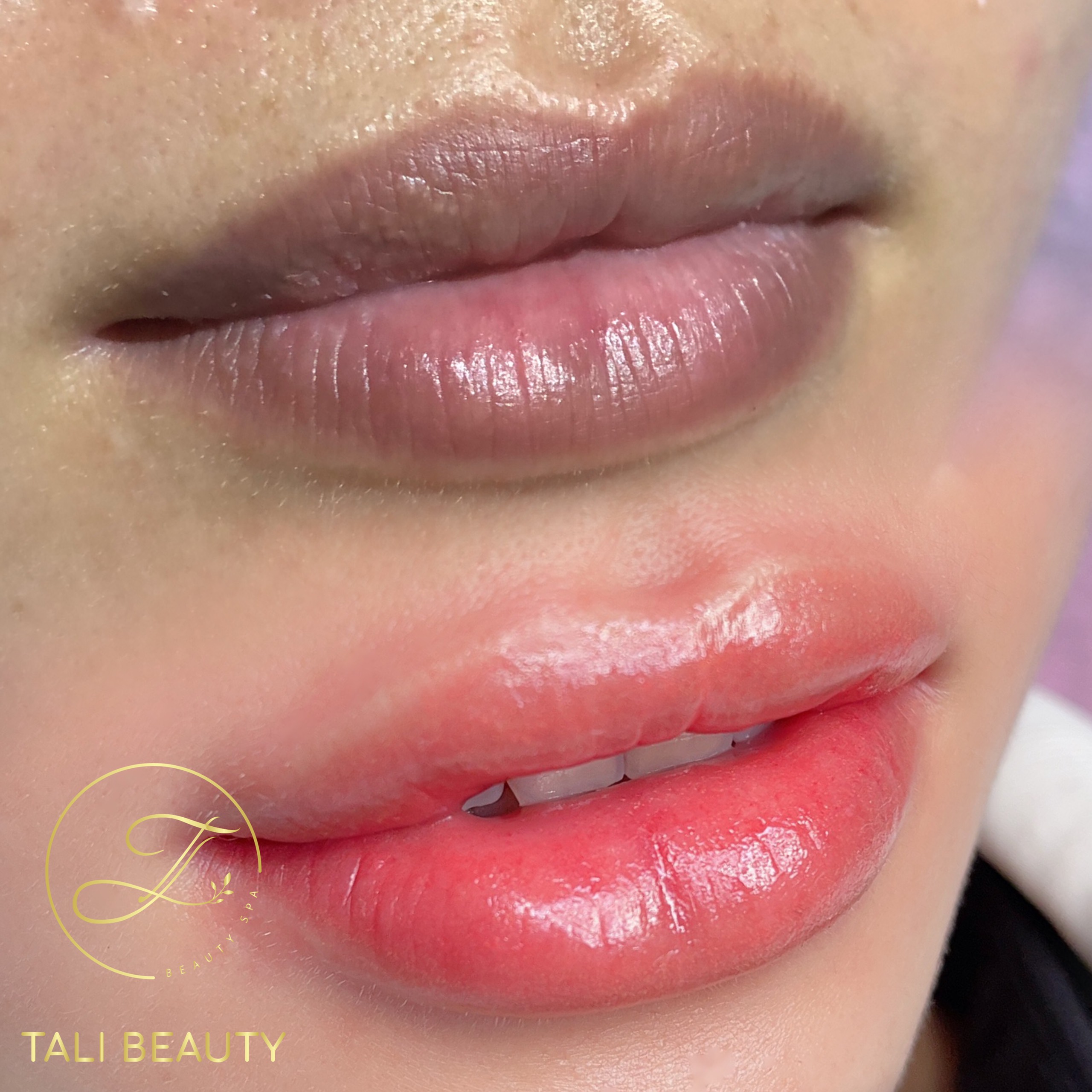 Phun Môi Candy Lip L-Lips Tali Beauty – Làn Môi Tươi Tắn, Tự Nhiên Quyến Rũ