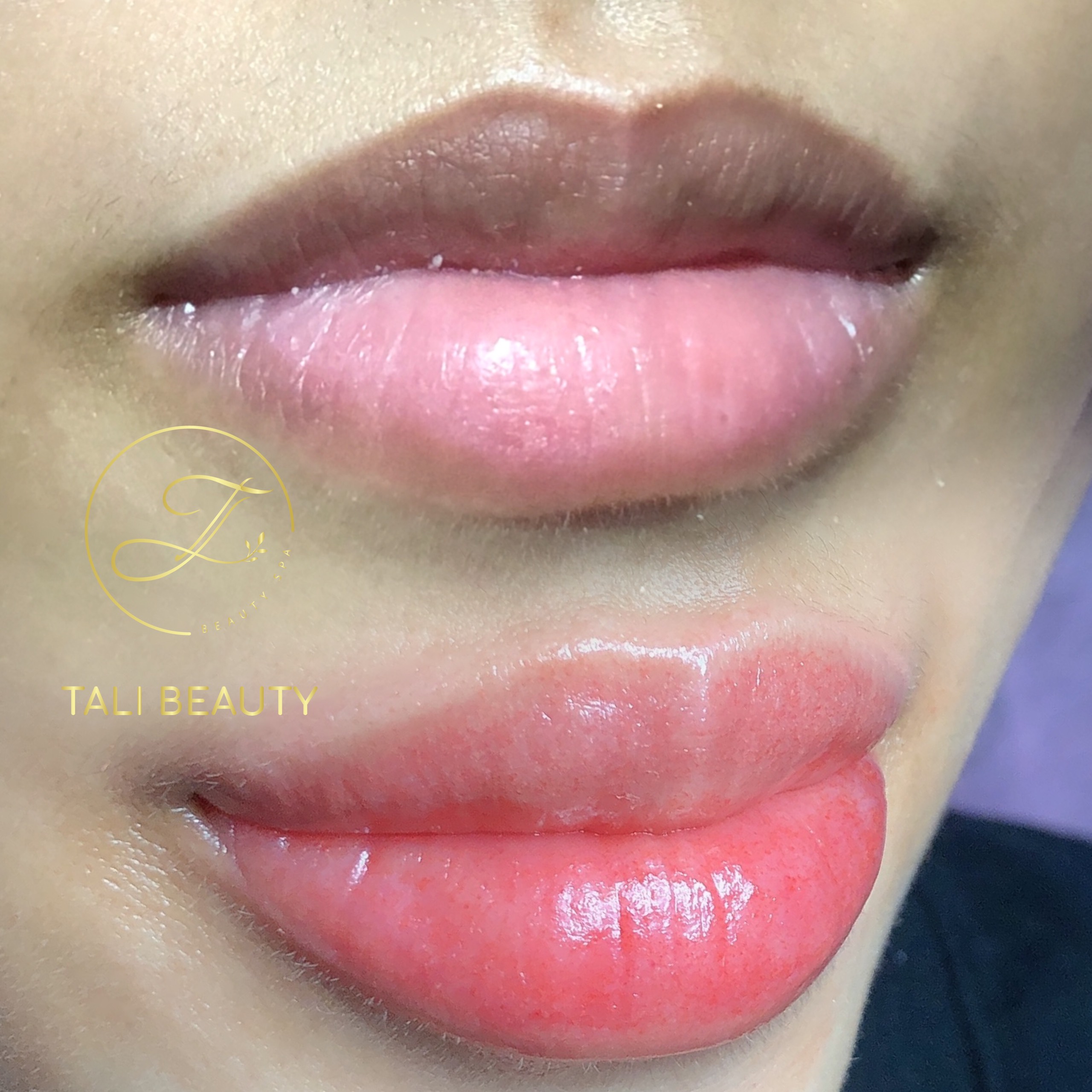 Phun Môi Candy Lip L-Lips Tali Beauty – Làn Môi Tươi Tắn, Tự Nhiên Quyến Rũ