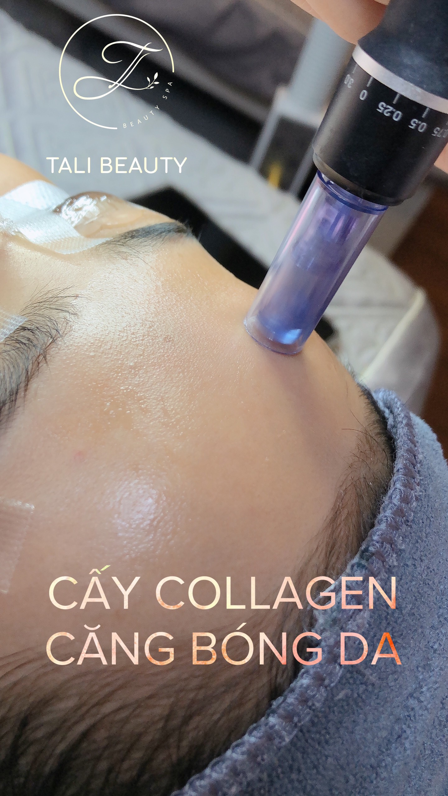 DỊCH VỤ CẤY COLLAGEN CĂNG BÓNG DA