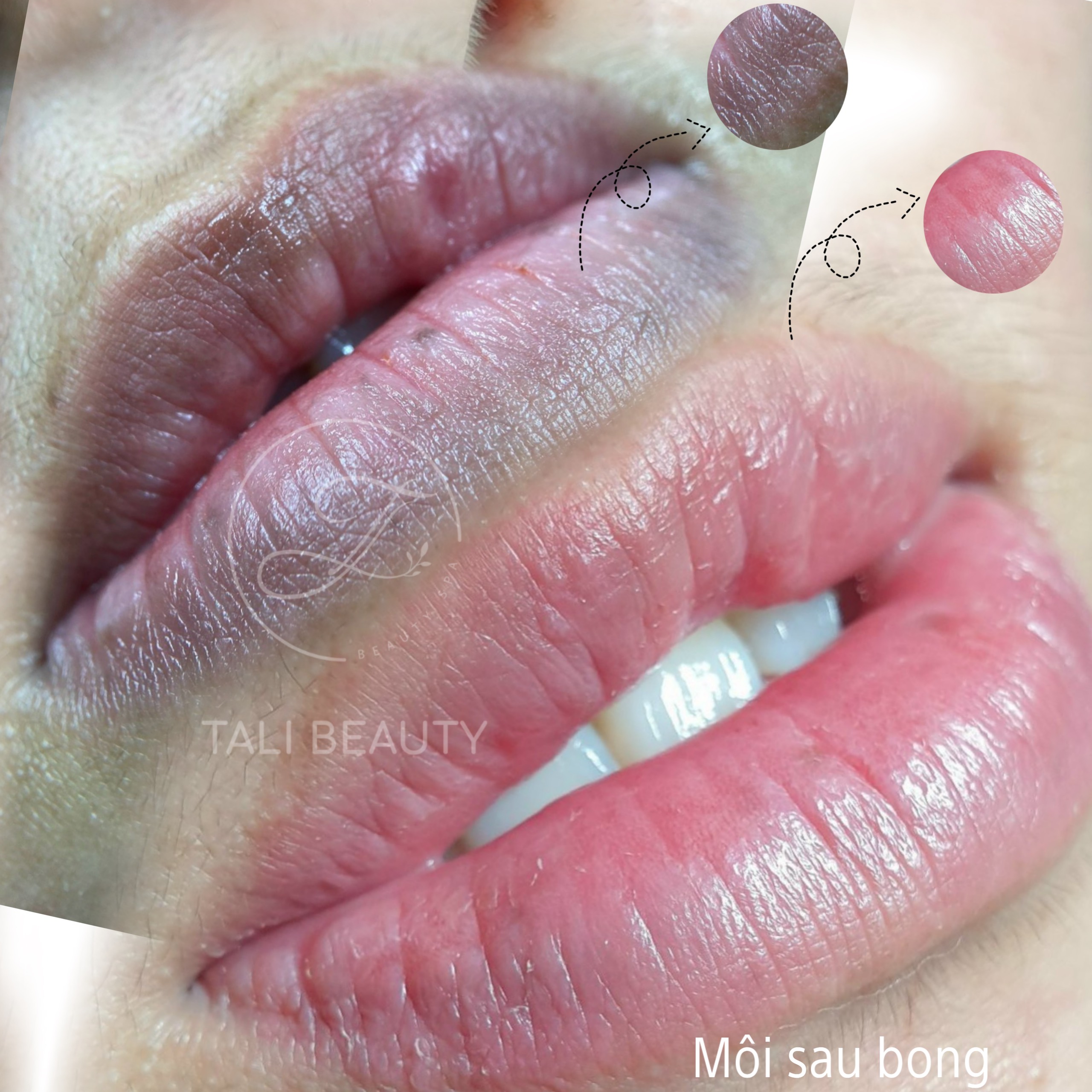 Phun Môi Candy Lip L-Lips Tali Beauty – Làn Môi Tươi Tắn, Tự Nhiên Quyến Rũ
